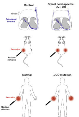 Mice lacking Dcc in the spinal cord have abnormal somatosensory cortex activation in response to noxious stimulation and fail to accurately localize noxious stimuli. DCC mutations in humans lead to mirroring of somatosensory stimuli. Cell Rep. 2018 Jan 30;22(5):1105-1114